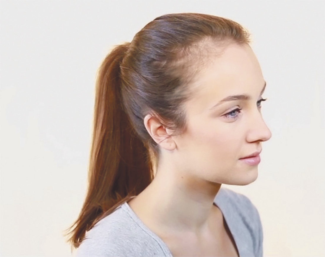 Laura has used Golden Brown TecTrich® Premium Hair Building Fibres to banish her thinning temples.